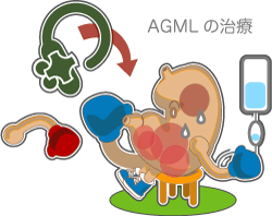 AGMLの治療